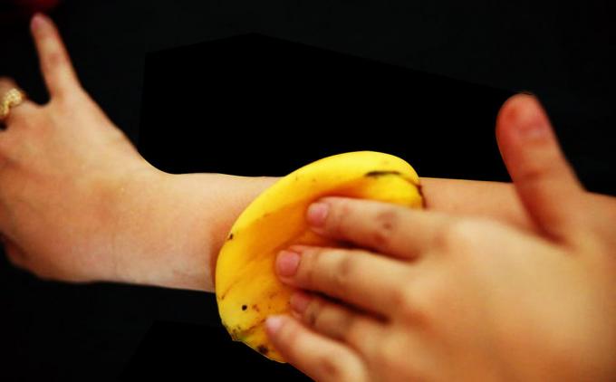 Banan skóry doskonale łagodzi swędzenie od ukąszenia komara