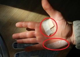 Jak poprawić rękawice zrezygnować z modzele?